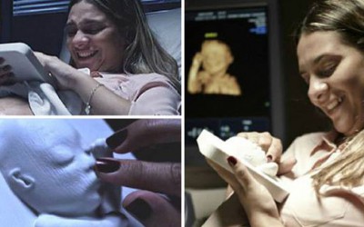 Gyönyörű: 3D-ben nyomtatták ki az ultrahangos képét a babának