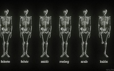 Óriási tévhit: röntgen felvételen mindenki ugyanolyan